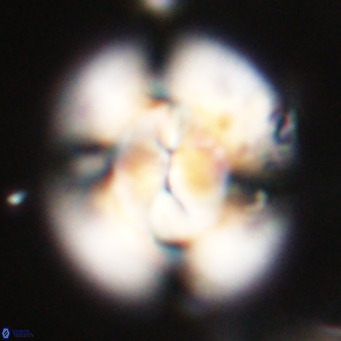 Dictyococcites stavensis VR 29367