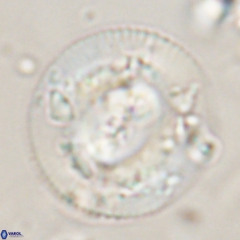 Dictyococcites stavensis VR 29373