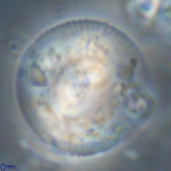Dictyococcites stavensis VR 29374