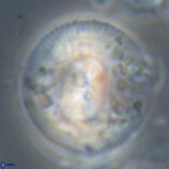 Dictyococcites stavensis VR 29375
