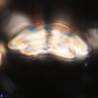 Dictyococcites stavensis VR 29379
