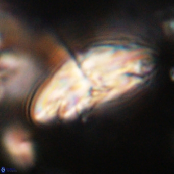 Dictyococcites stavensis VR 29382