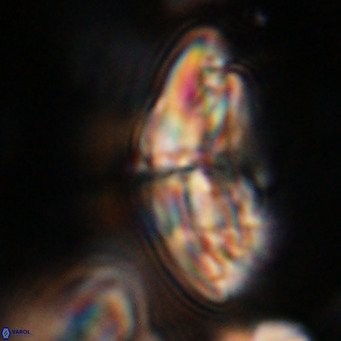 Dictyococcites stavensis VR 29383