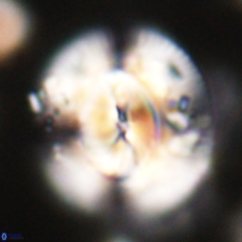 Dictyococcites stavensis VR 29385