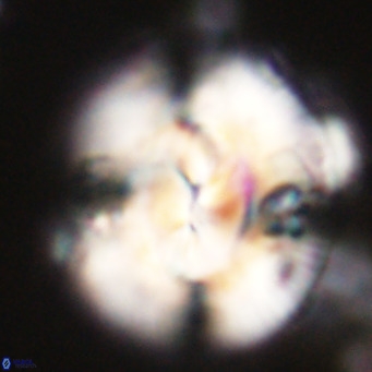 Dictyococcites stavensis VR 29390