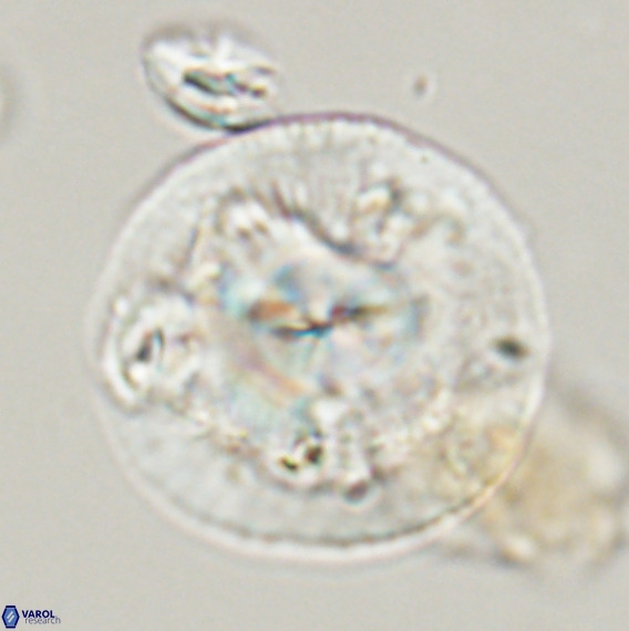 Dictyococcites stavensis VR 33272