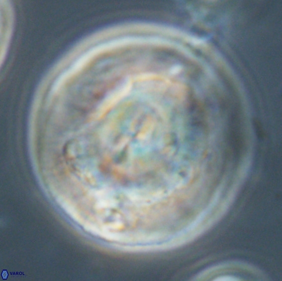 Dictyococcites stavensis VR 33277