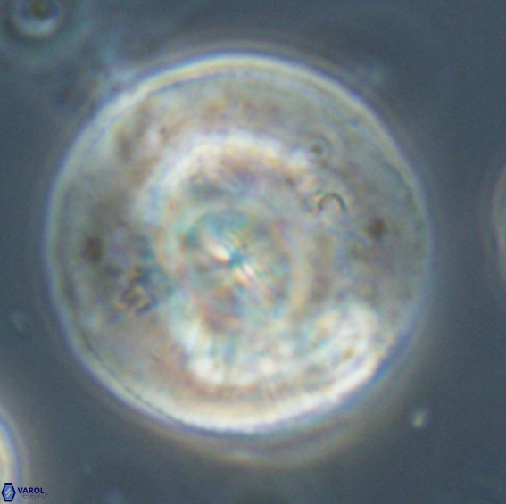 Dictyococcites stavensis VR 33278