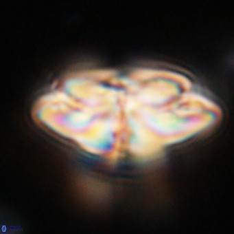 Dictyococcites stavensis VR 33290