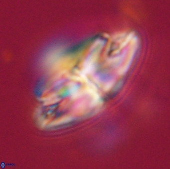 Dictyococcites stavensis VR 33294