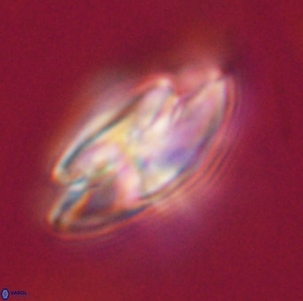 Dictyococcites stavensis VR 33295