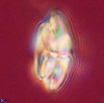 Dictyococcites stavensis VR 33298