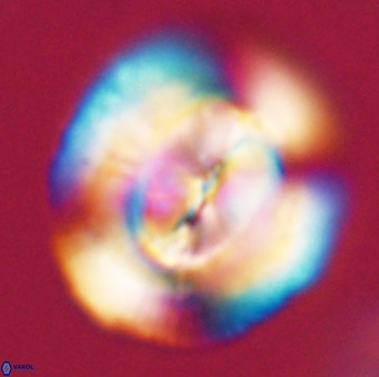 Dictyococcites stavensis VR 33299