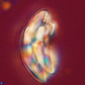 Dictyococcites stavensis VR 33307