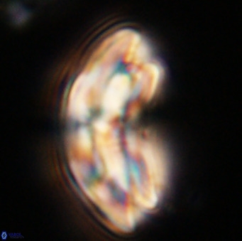Dictyococcites stavensis VR 33308