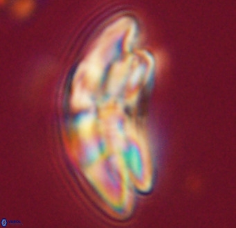 Dictyococcites stavensis VR 33311