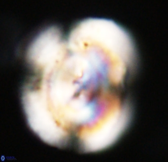 Dictyococcites stavensis VR 33313