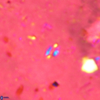 Didimospyrgos inciae VR 00096