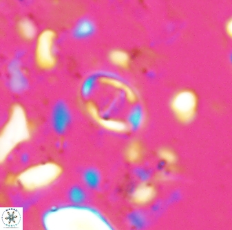 Diploteichus caliginosus 07638