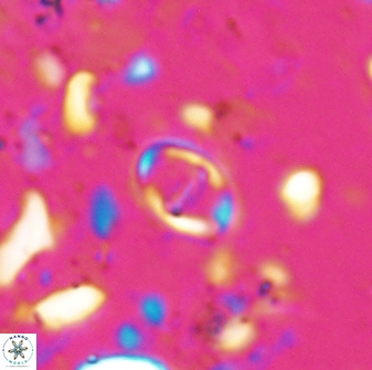 Diploteichus caliginosus 07639