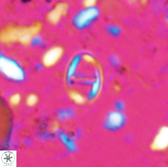 Diploteichus caliginosus 07641