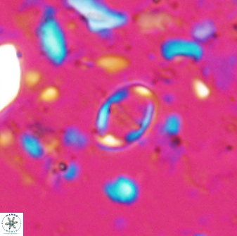 Diploteichus caliginosus 07643