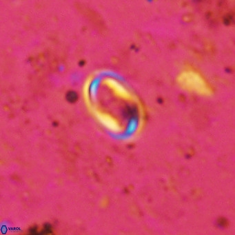 Diploteichus clarus VR 15904