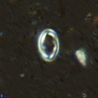 Diploteichus clarus VR 15906