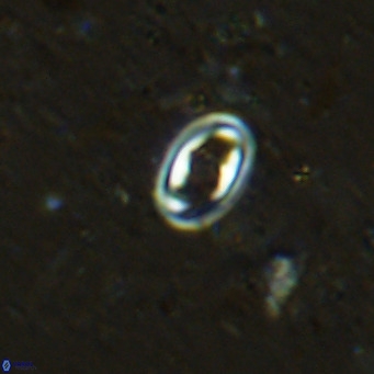 Diploteichus clarus VR 15909