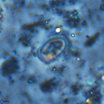 Diploteichus clarus VR 15914