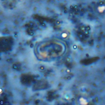 Diploteichus clarus VR 15913