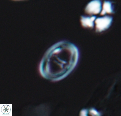 Diploteichus divergibrachia 10658