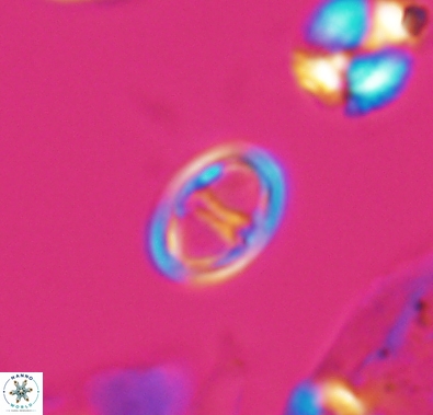 Diploteichus divergibrachia 10659
