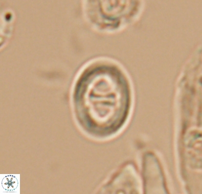 Diploteichus divergibrachia 10660