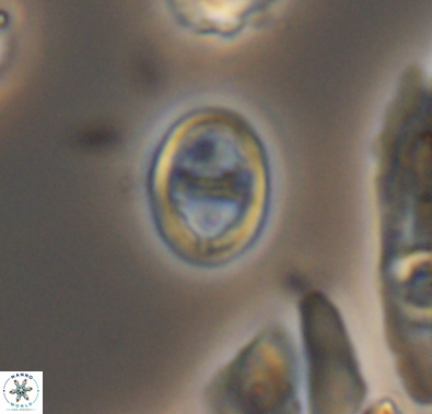 Diploteichus divergibrachia 10661