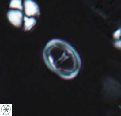 Diploteichus divergibrachia 10662