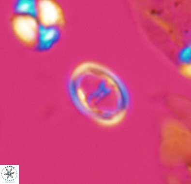 Diploteichus divergibrachia 10663