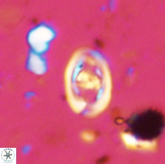 Diploteichus trivectis 48586