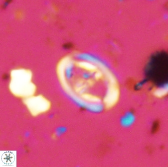 Diploteichus trivectis 48588