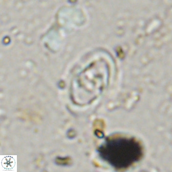 Diploteichus trivectis 48594