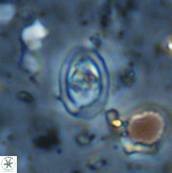 Diploteichus trivectis 48596