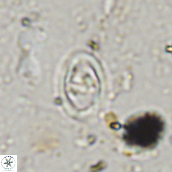 Diploteichus trivectis 48591