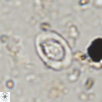 Diploteichus trivectis 48592