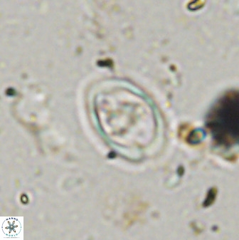 Diploteichus trivectis 48593