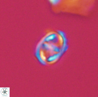 Diploteichus trivectis 48620