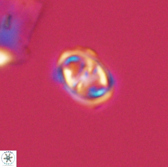 Diploteichus trivectis 48623