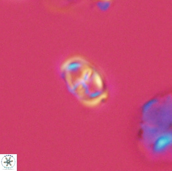 Diploteichus trivectis 48639