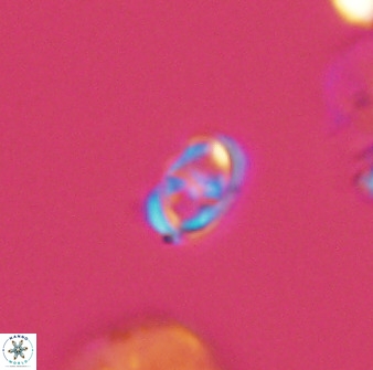 Diploteichus trivectis 48645