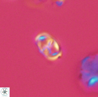 Diploteichus trivectis 48641
