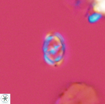 Diploteichus trivectis 48643